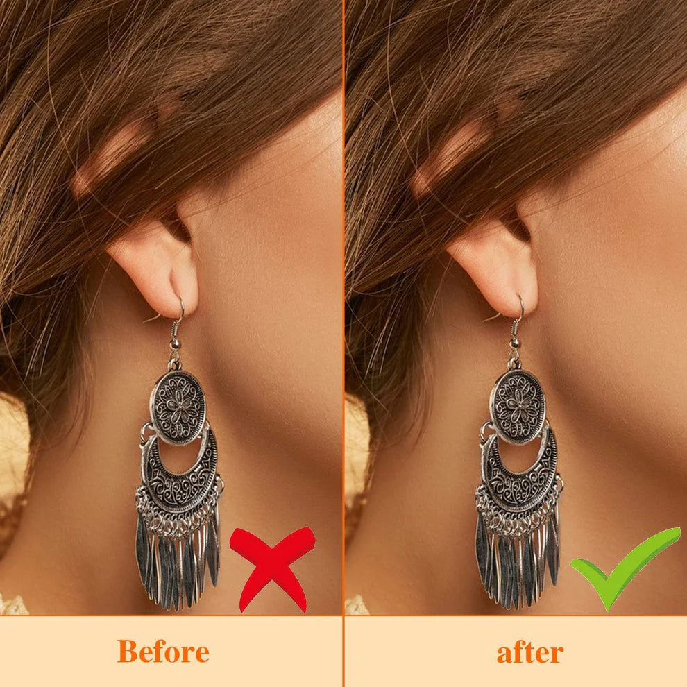 Earlobe Support Patches – Invisible Protection for Your Ears (100 pcs)-.g